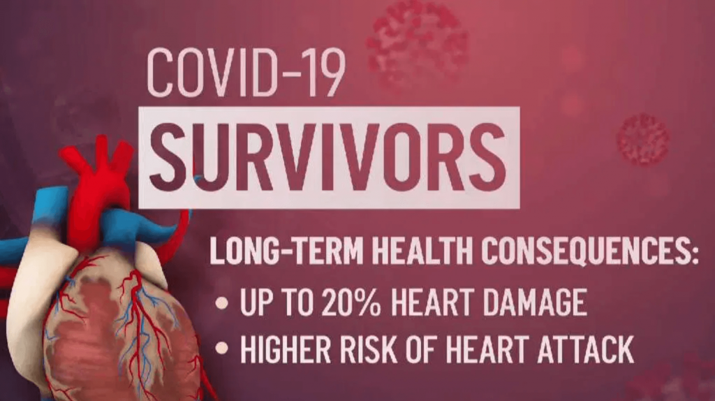 COVID 19 Vascular Impacts