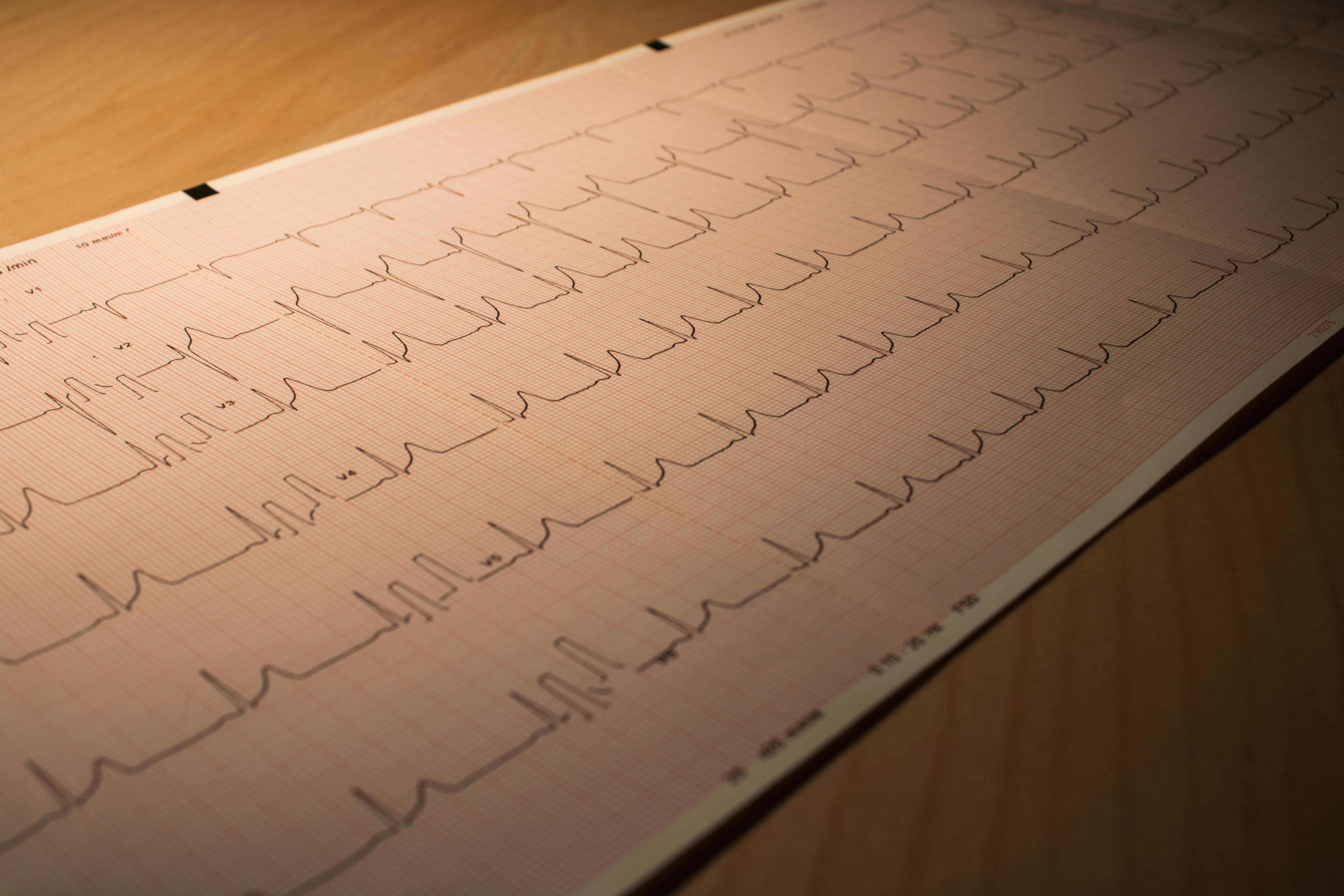 Understanding Skipped Heartbeats: Causes & Treatments